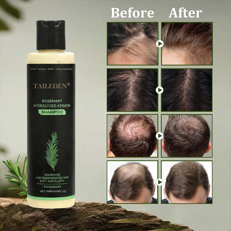(🔥LAST 3 HOURS SALE - 70% OFF)🌱 TAILEDEN™ Organic Rosemary Hair Growth Shampoo